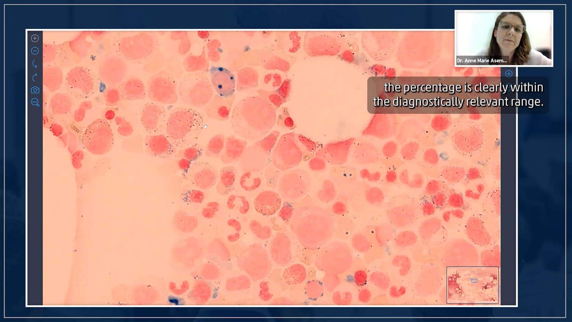 DCHVideoScreenshot01