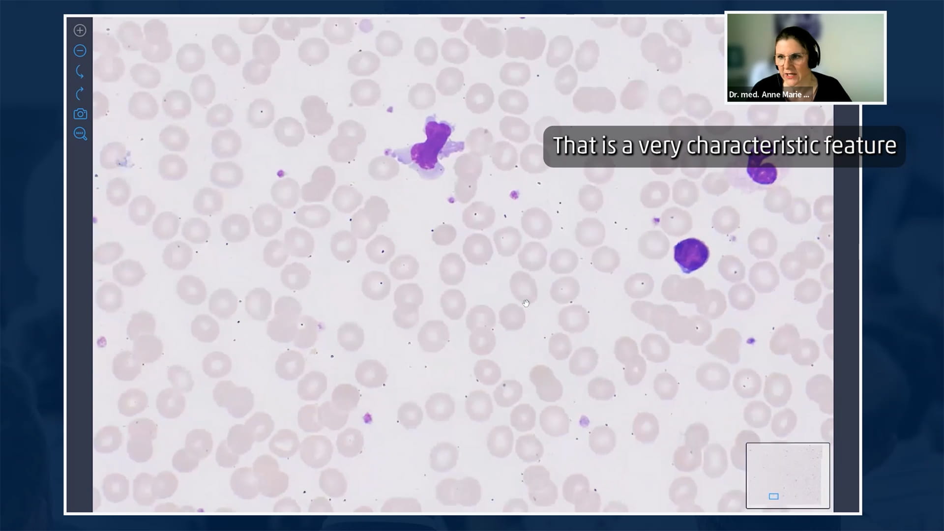 DCHVideoScreenshot02