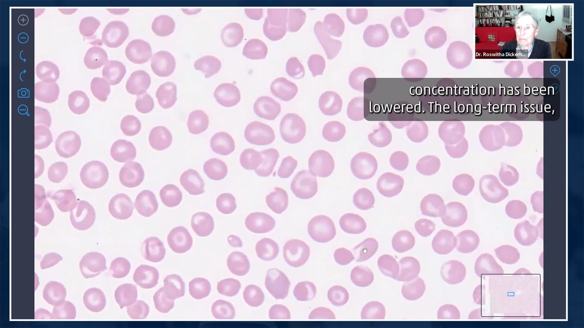 DCHVideoScreenshot03